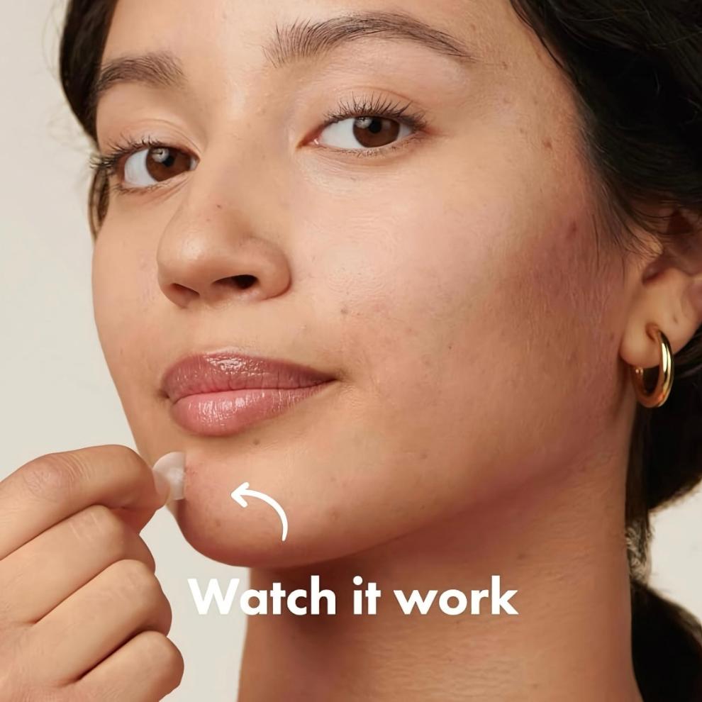 Mighty Patch™ Acne Shield