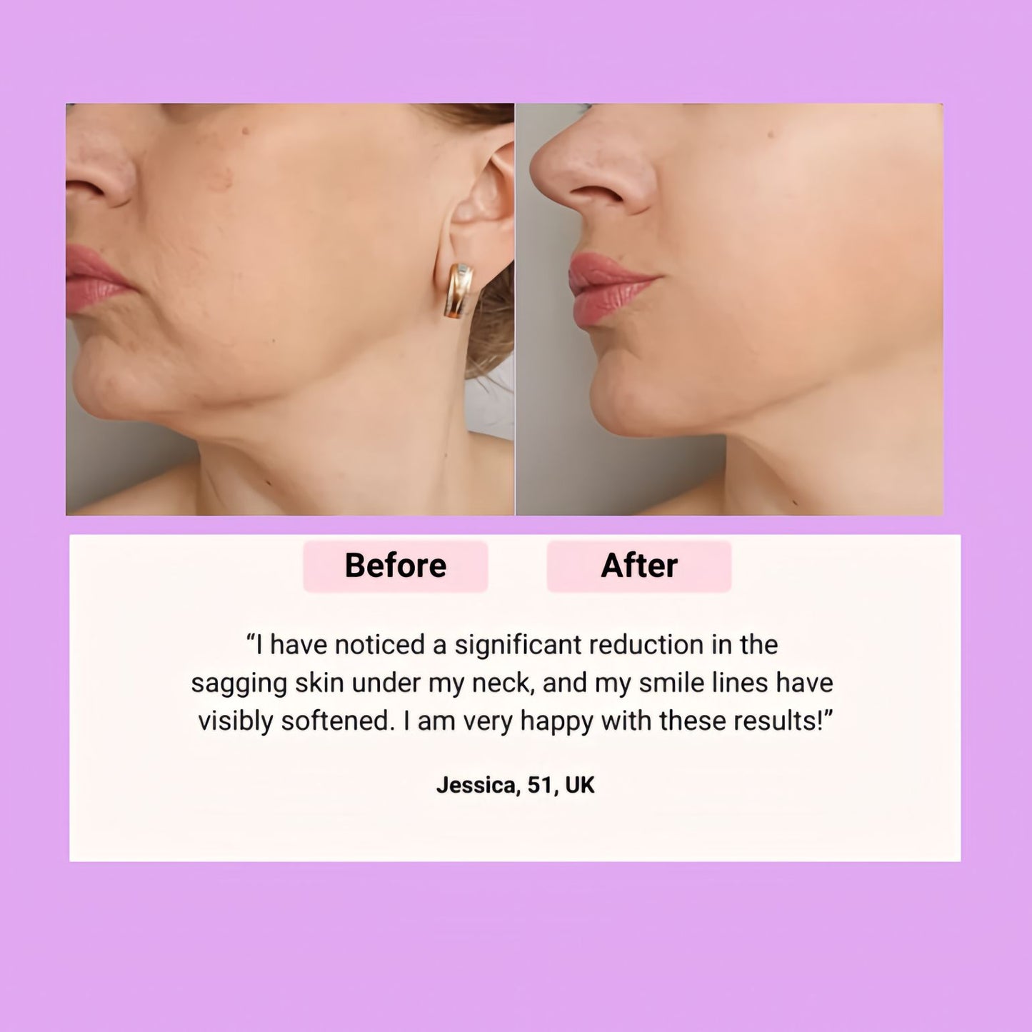 DeepCera Bakuchioil ™serum