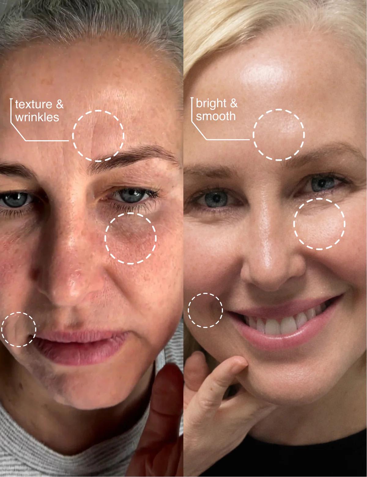 CryoGlow™ Hot & Cold Skin Cleansing Tool