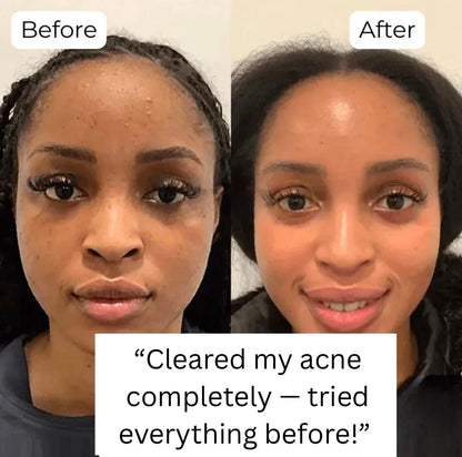 CryoGlow™ Hot & Cold Skin Cleansing Tool