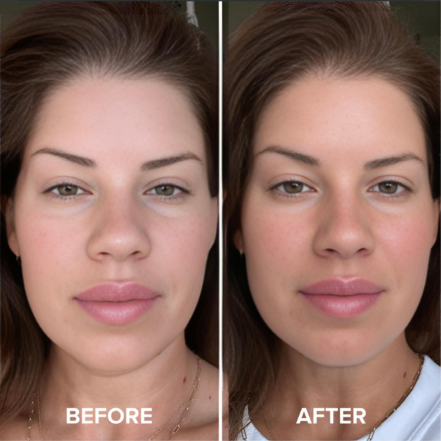 DermaFrost™ Ice Massage Roller