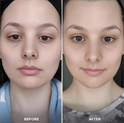 DermaFrost™ Ice Massage Roller