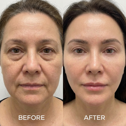 Derma Face Sculptor