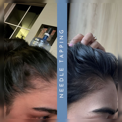 PlumStar Dermal Hammer Set