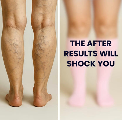 VenoFlex™ Elite Compression Socks